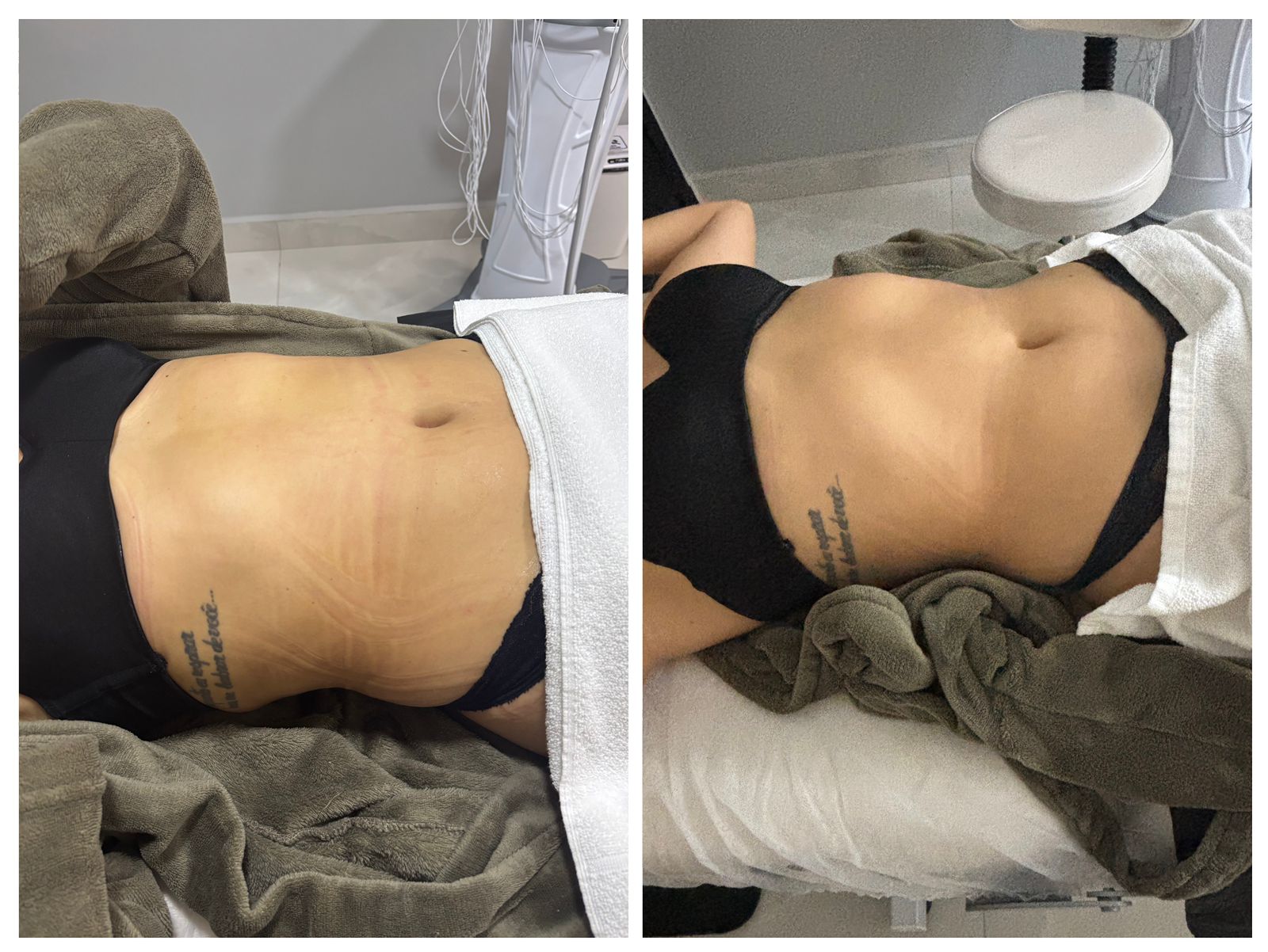 Drenagem Modeladora